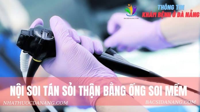 Tán sỏi thận bằng ống soi mềm Tán sỏi thận bằng ống soi mềm tại đà nẵng
