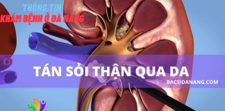 Tán sỏi thận qua da tại đà nẵng