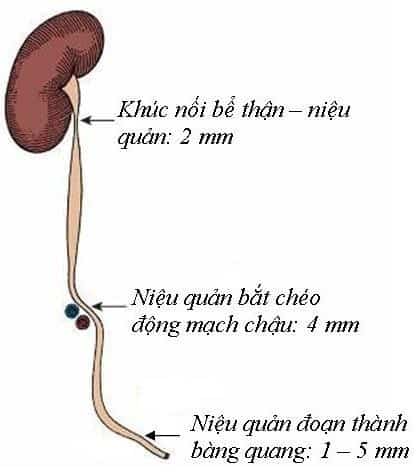 Niệu quản có ba vị trí hẹp tự nhiên: một ở khúc nối bể thận – niệu quản, một ở nơi niệu quản bắt chéo động mạch chậu và một ở trong thành bàng quang