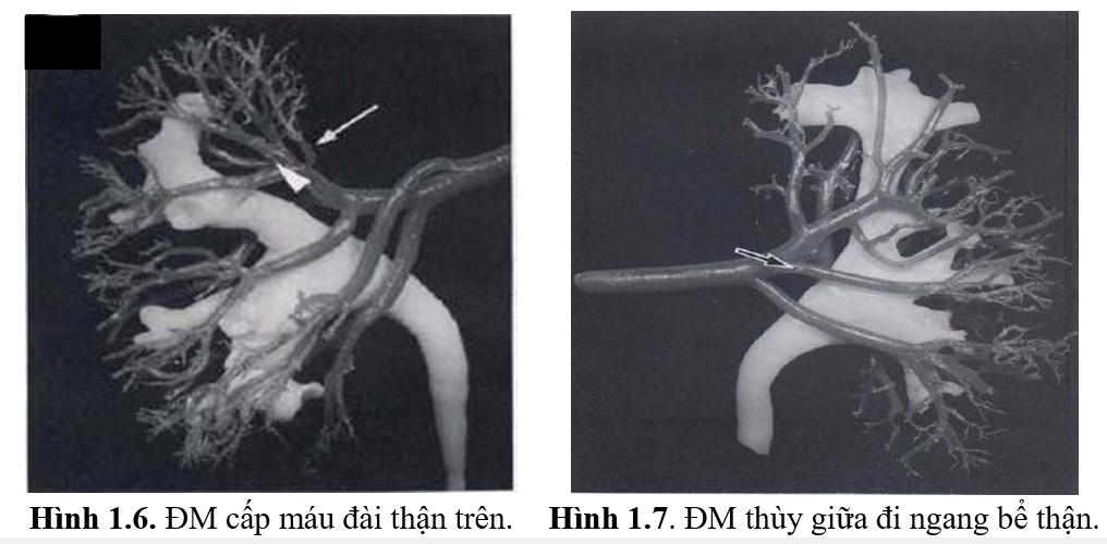 GIẢI PHẪU HỌC TRONG PHẪU THUẬT THẬN QUA DA