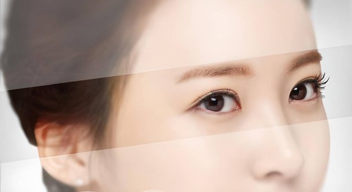 Treo cung chân mày bằng chỉ