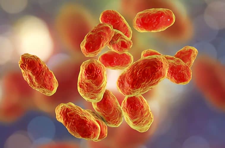 Mycoplasma hominis là một loài vi khuẩn trong chi Mycoplasma