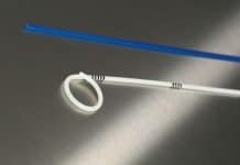 Sonde JJ niệu quản