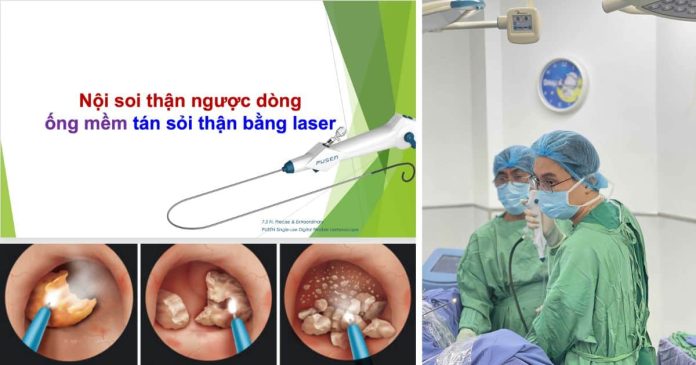 Nội soi thận ống mềm tán sỏi bằng laser tại Đà Nẵng (1)