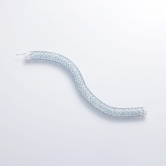 stent nieu quan kim loai