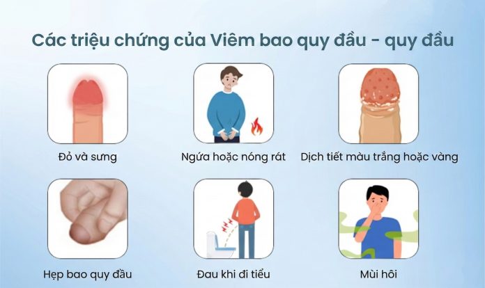 viem bao quy dau man tinh